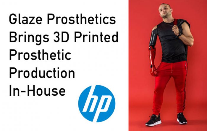 Glaze Prosthetics Brings 3D Printed Prosthetic Production In-House with HP