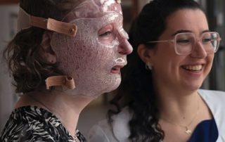 printing 3D Printing Face Masks for burn victims