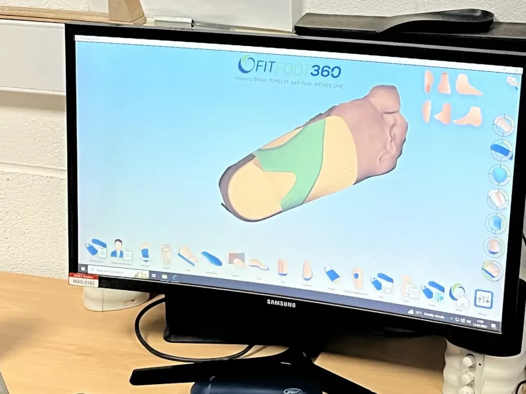 3D printing MAG Orthotics