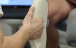 3D scanning for medical