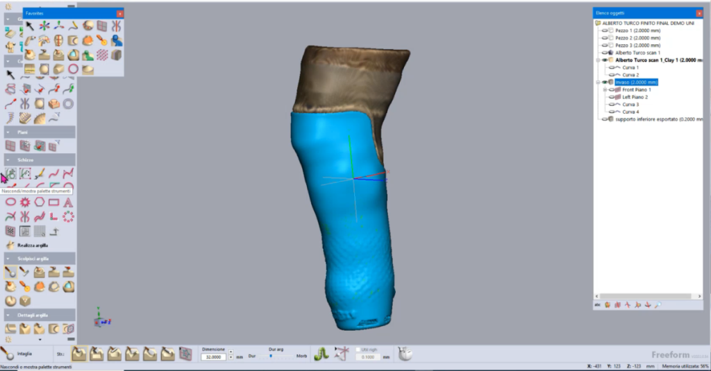 A leg prosthesis was designed using Freeform and 3D-printed on an HP machine with PA12 material. The entire process took under half a workday: 15 minutes for scanning, 45 minutes for design, and a few hours for printing.