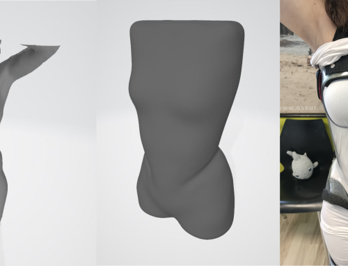 Advancing Orthotics & Prosthetics through Digital Innovation with Freeform